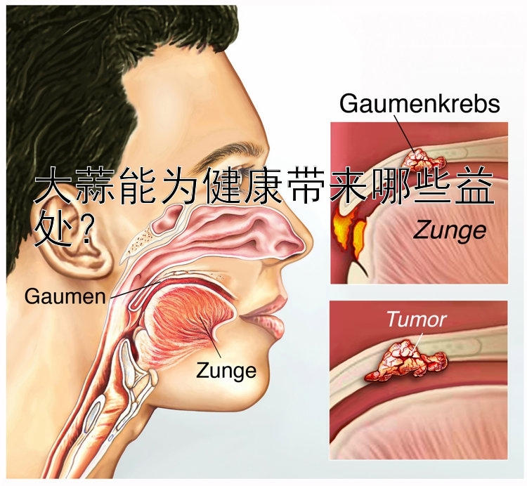 大蒜能为健康带来哪些益处？