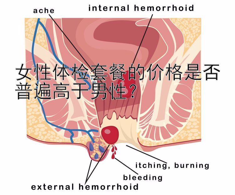 女性体检套餐的价格是否普遍高于男性？