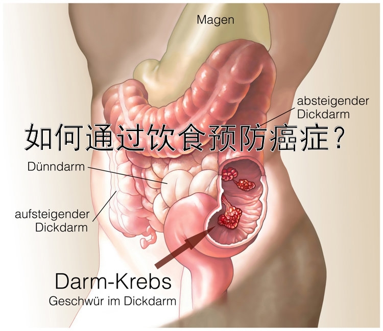 如何通过饮食预防癌症？