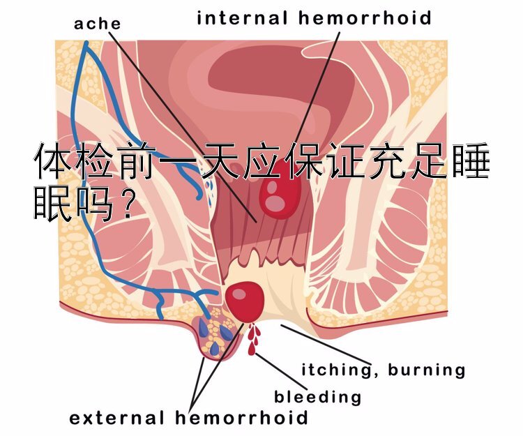 体检前一天应保证充足睡眠吗？