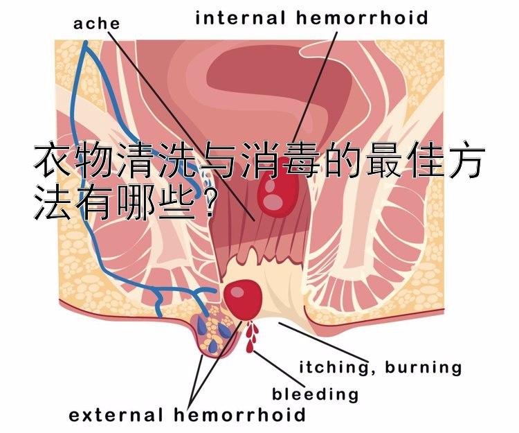 衣物清洗与消毒的最佳方法有哪些？