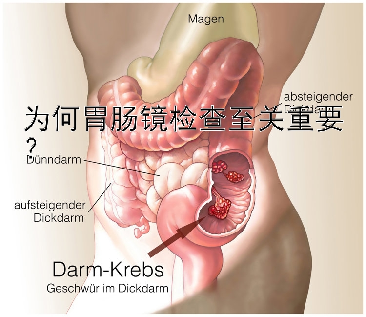 为何胃肠镜检查至关重要？