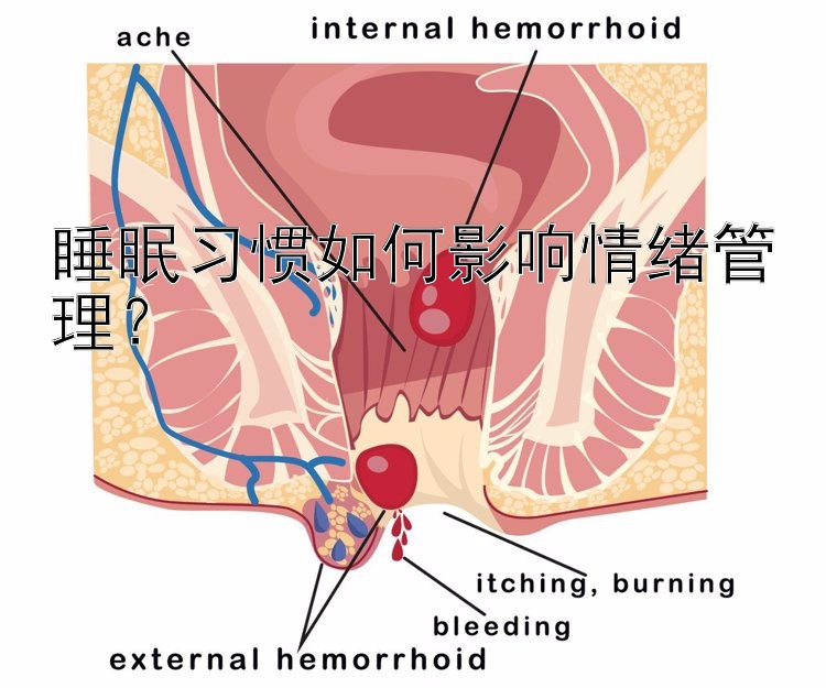 睡眠习惯如何影响情绪管理？