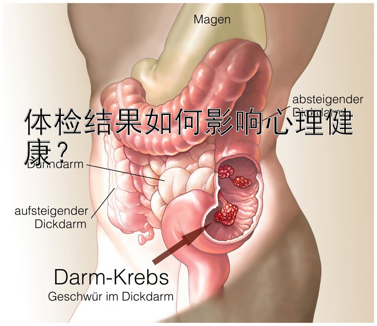 体检结果如何影响心理健康？