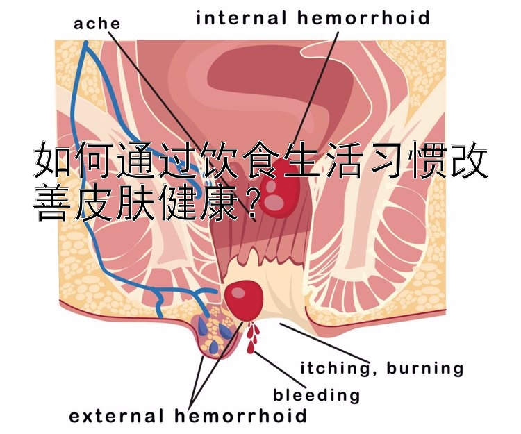 如何通过饮食生活习惯改善皮肤健康？