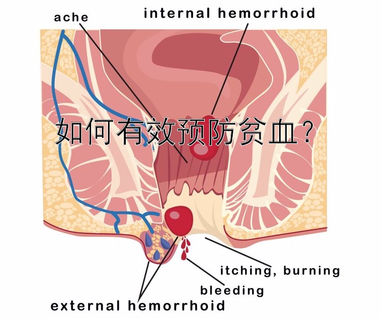 如何有效预防贫血？