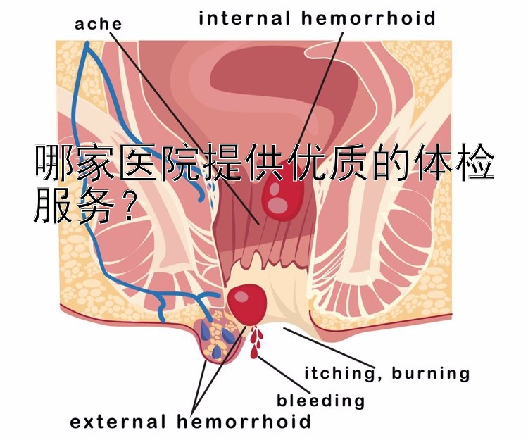 哪家医院提供优质的体检服务？