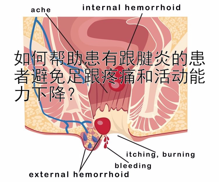 如何帮助患有跟腱炎的患者避免足跟疼痛和活动能力下降？