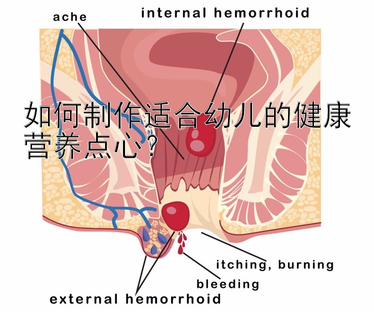 如何制作适合幼儿的健康营养点心？