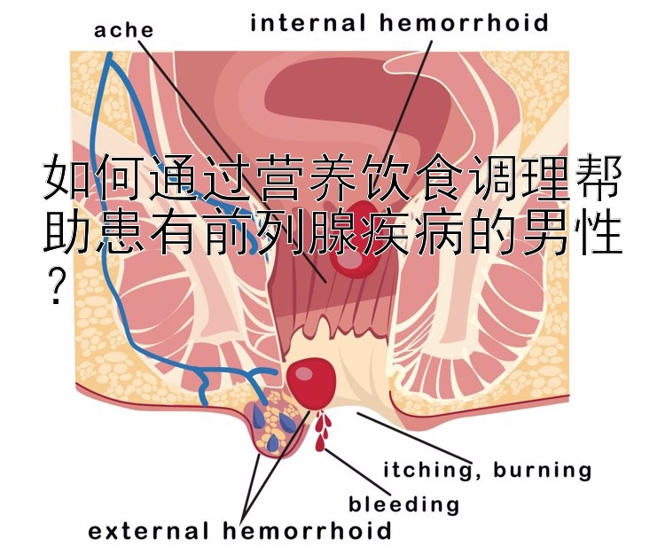 如何通过营养饮食调理帮助患有前列腺疾病的男性？