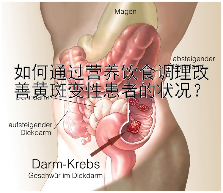 如何通过营养饮食调理改善黄斑变性患者的状况？