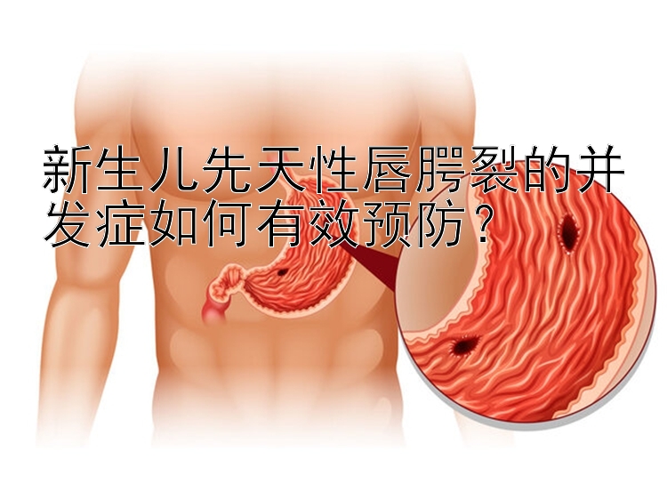 新生儿先天性唇腭裂的并发症如何有效预防？