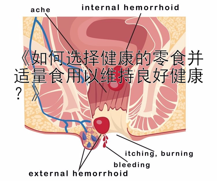 《如何选择健康的零食并适量食用以维持良好健康？》