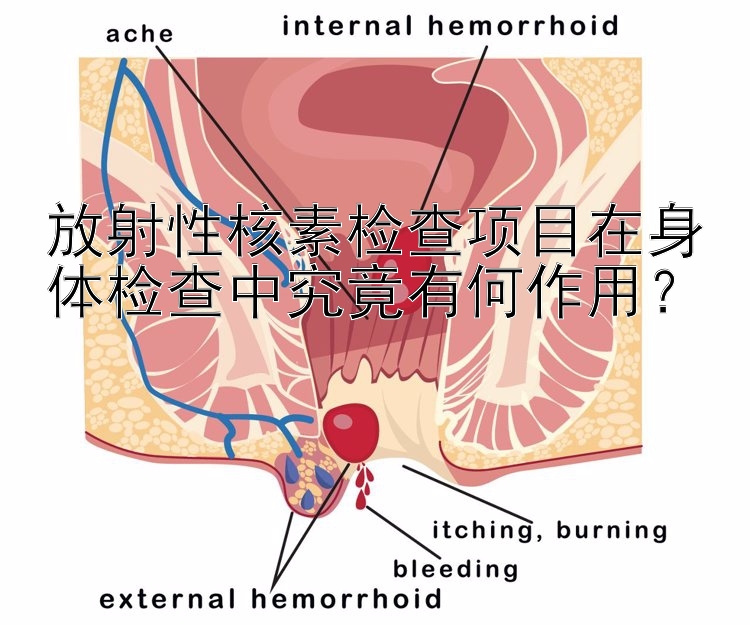 放射性核素检查项目在身体检查中究竟有何作用？